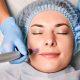 microneedling
